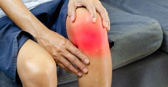 What Is Knee Bursitis and How Can You Find Relief?